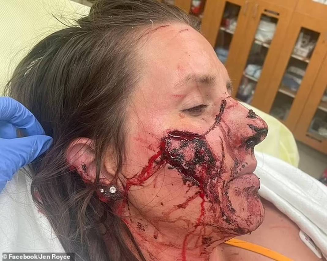 Nehre girdi, kanlar içinde çıktı! O canavar yüzünü paramparça etti... Arkasından usulca gelip... 2